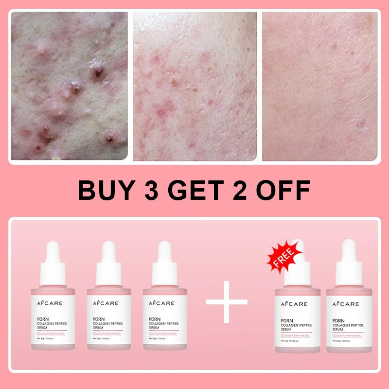 Salmon PDRN Collagen Peptide Serum