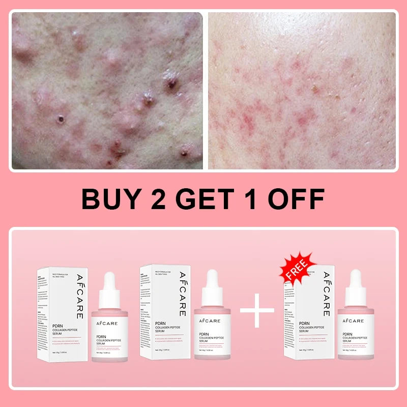 Salmon PDRN Collagen Peptide Serum